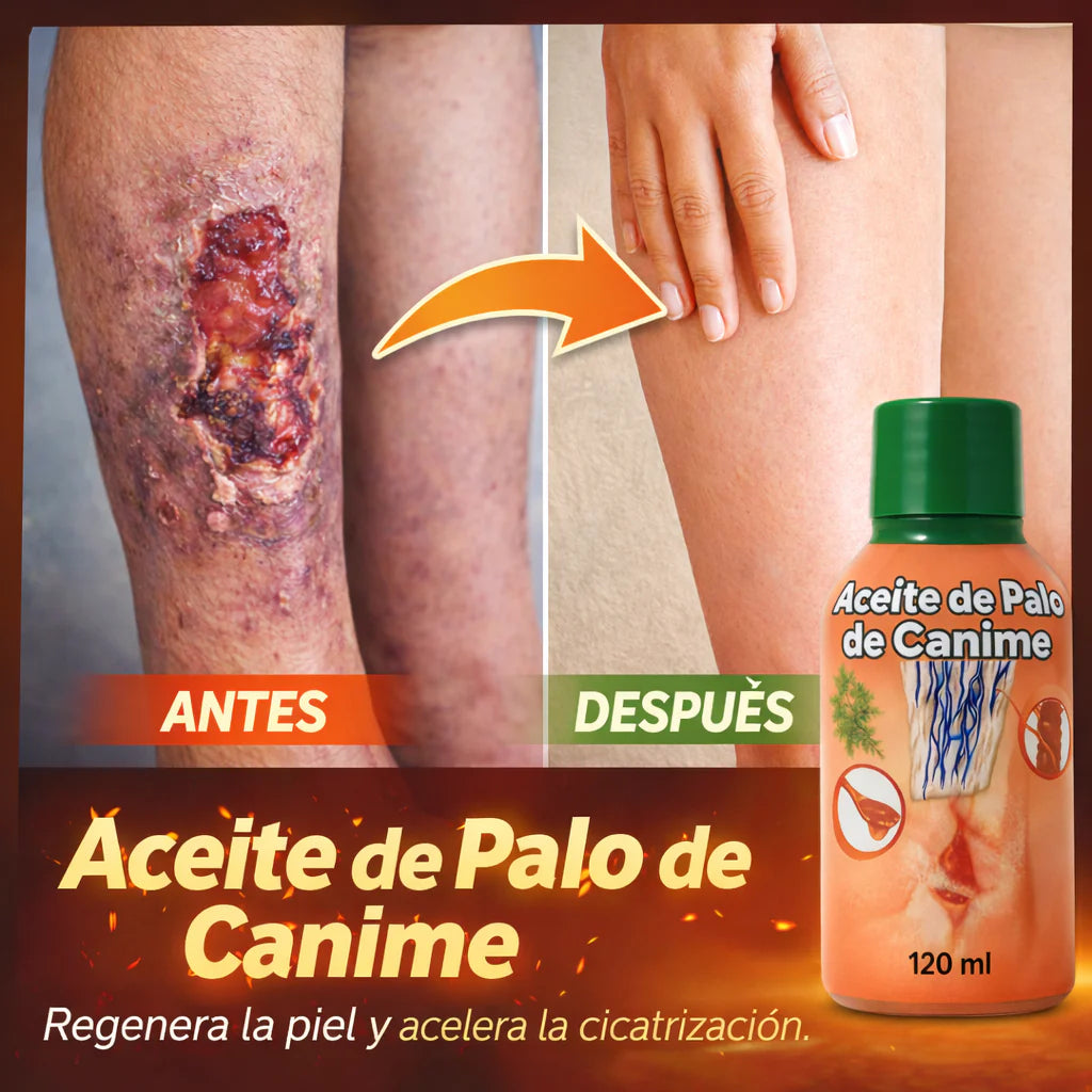 🌿 Aceite de Palo de Canime | Alivio Natural para Piernas Cansadas y Circulación 💆♂️✨