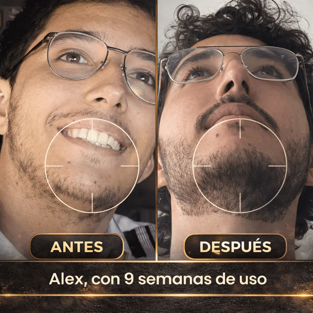 Bálsamo Estimulante de Barba Apolo Ultra Potente 100ml | Más Crecimiento y Densidad