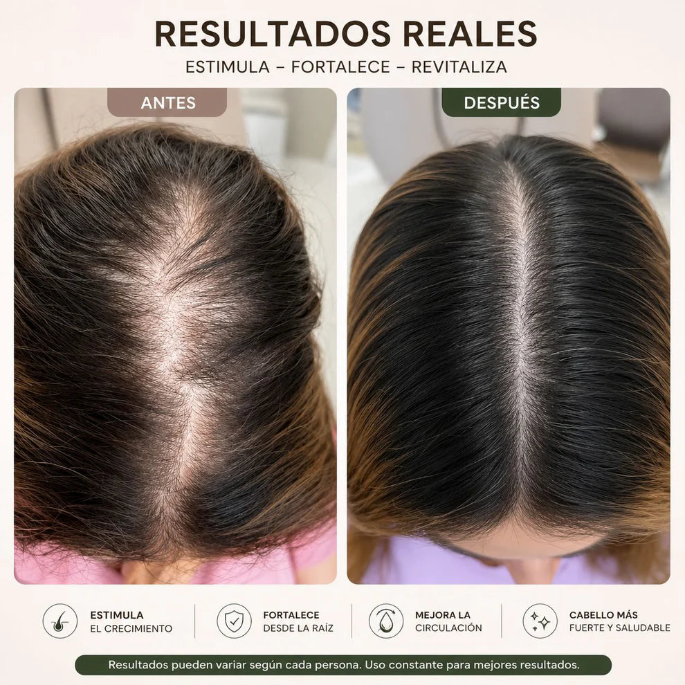 ✨ Cabello Liso, Brillante y Sin Frizz 💁‍♀️ | Ayuda a Reducir la Caída por Quiebre y Cuida tu Cuero Cabelludo 🌿