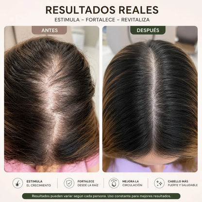✨ Cabello Liso, Brillante y Sin Frizz 💁‍♀️ | Ayuda a Reducir la Caída por Quiebre y Cuida tu Cuero Cabelludo 🌿